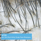 Dry & Itchy Scalp Care Shampoo